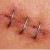 wounds.jpg